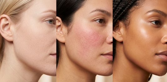 Different skin types eczema rosacea healthy skin K-beauty solution