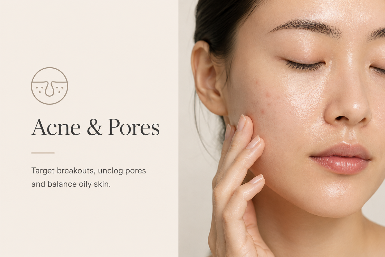 Acne & Pores